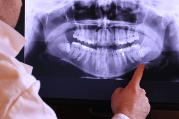 Best Emergency Broken Tooth Repair in San Tan Valley, AZ