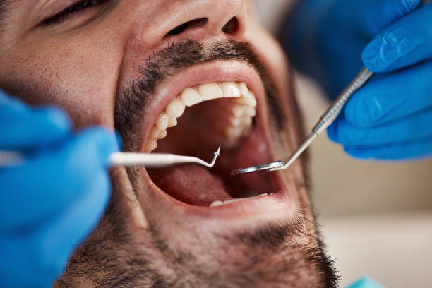 Best Emergency Dental Care for Trauma or Injury in San Tan Valley, AZ